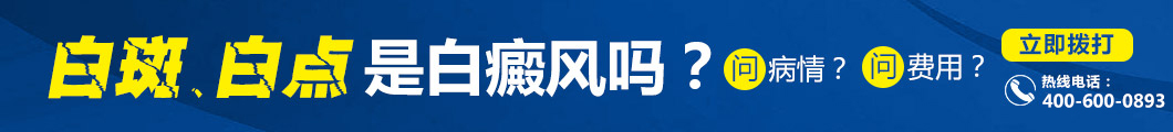 阜阳白斑医院哪家效果好