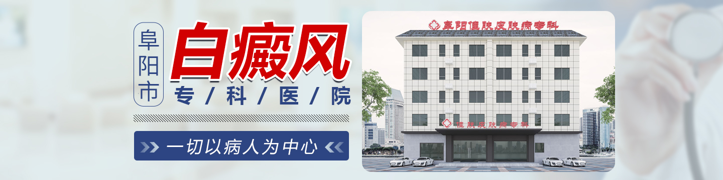 阜阳白斑医院