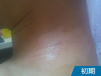 阜阳看白斑那家医院好