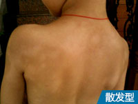 阜阳白斑医院排行榜